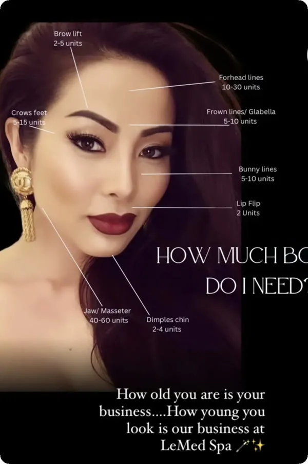 Botox injection points diagram featuring Lea at LeMed Spa
